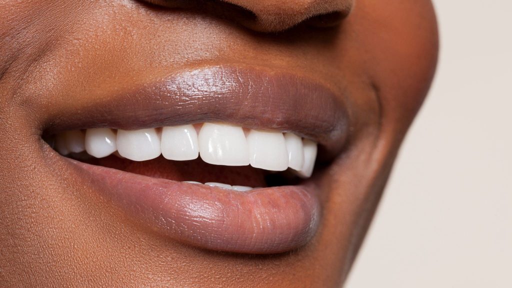 TikTok : méfiez-vous de la tendance du limage des dents !