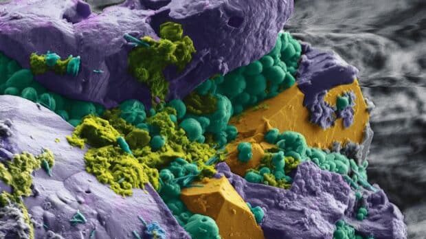 microbes intra terrestres vus au microscope