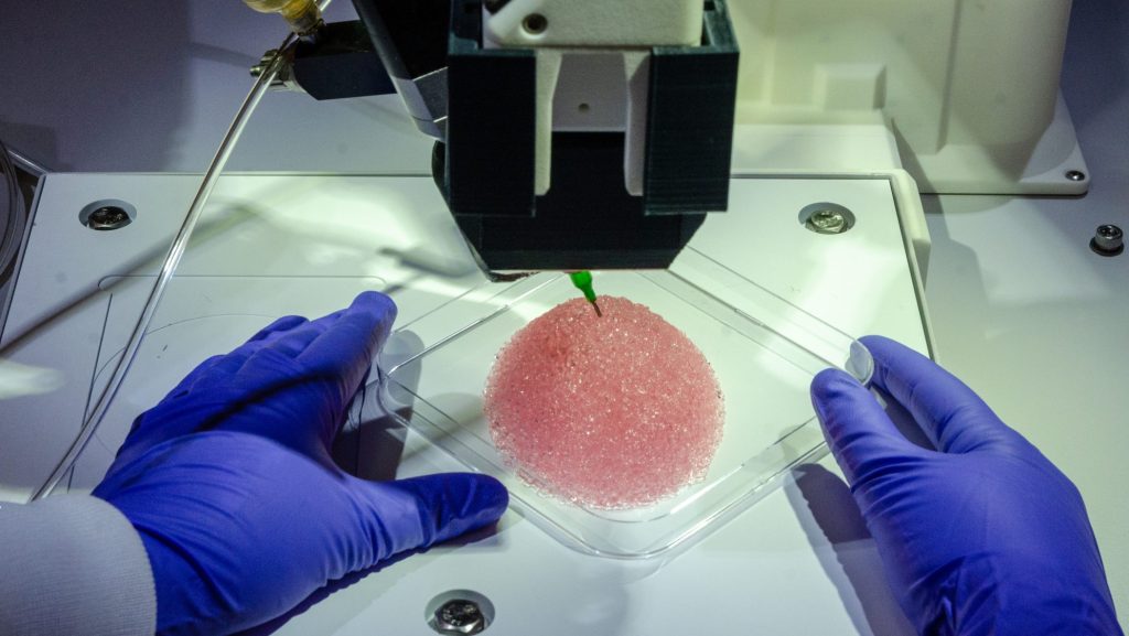 Healshape : une solution naturelle pour la reconstruction mammaire