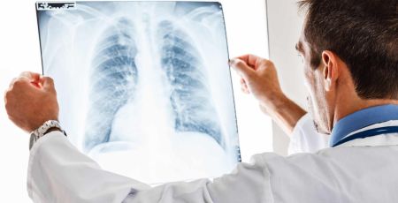 medecin regarde radio des poumons