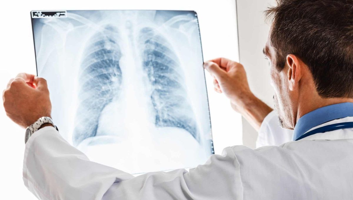medecin regarde radio des poumons