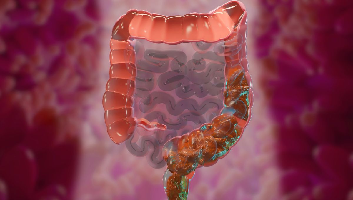 COLON