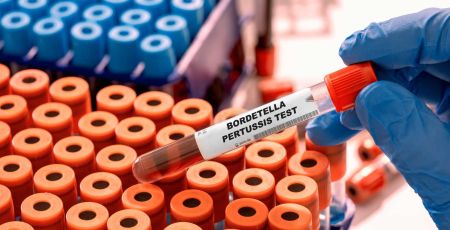 éprouvette de test bactérie bordetella pertussis