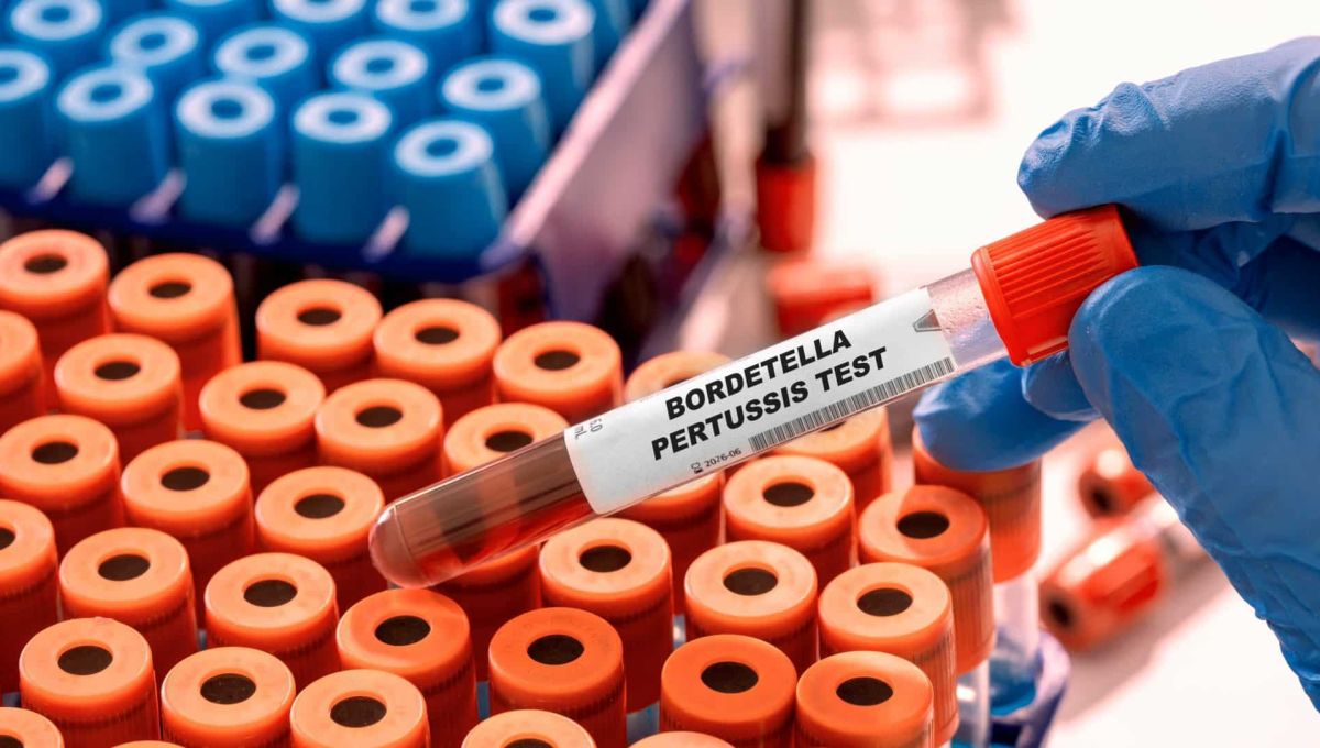 éprouvette de test bactérie bordetella pertussis
